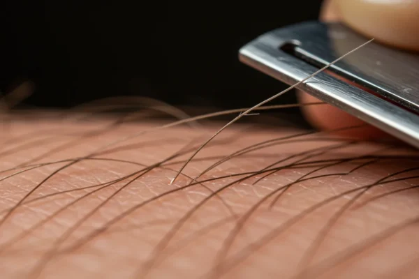 Men’s Ingrown Hair: Flawed Grooming in 2026?